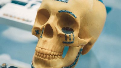 Kdo bo v prihodnje izvajal kirurško zdravljenje raka v ustni votlini, zdravil ponesrečene z izjemno hudimi poškodbami obraza ali operiral otroke, ki se rodijo s prirojeno razvojno anomalijo obraza in ustne votline?