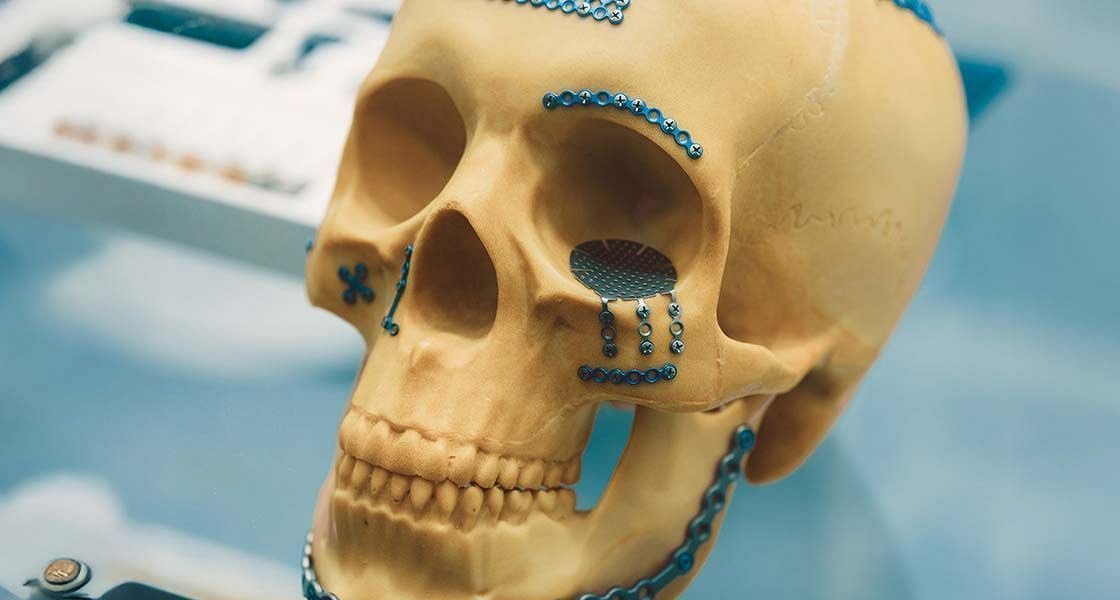 Kdo bo v prihodnje izvajal kirurško zdravljenje raka v ustni votlini, zdravil ponesrečene z izjemno hudimi poškodbami obraza ali operiral otroke, ki se rodijo s prirojeno razvojno anomalijo obraza in ustne votline?