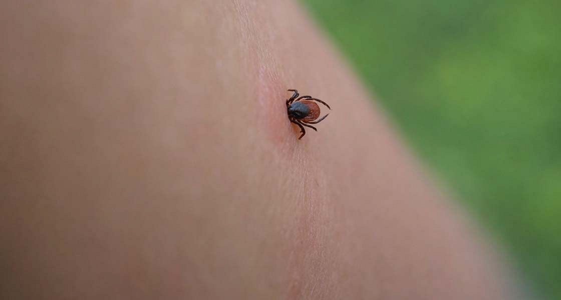 Klopni meningoencefalitis in lymska oziroma lajmska borelioza: pred odhodom v naravo se zaščitite, da vam vbod okuženega klopa ne ohromi življenja