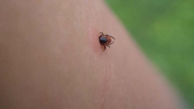 Klopni meningoencefalitis in lymska oziroma lajmska borelioza: pred odhodom v naravo se zaščitite, da vam vbod okuženega klopa ne ohromi življenja