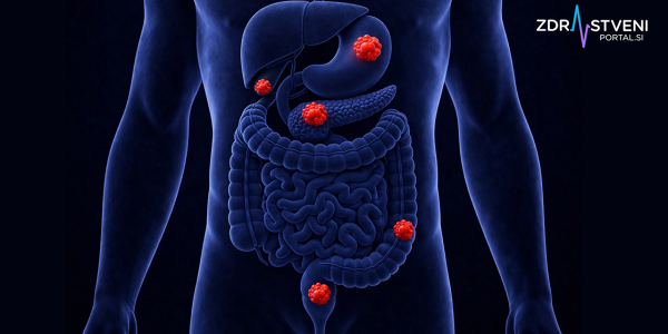 Rak debelega črevesja, rak trebušne slinavke in rak želodca: vzroki in preprečevanje, simptomi in čim zgodnejša diagnostika treh najpogostejših rakov prebavil