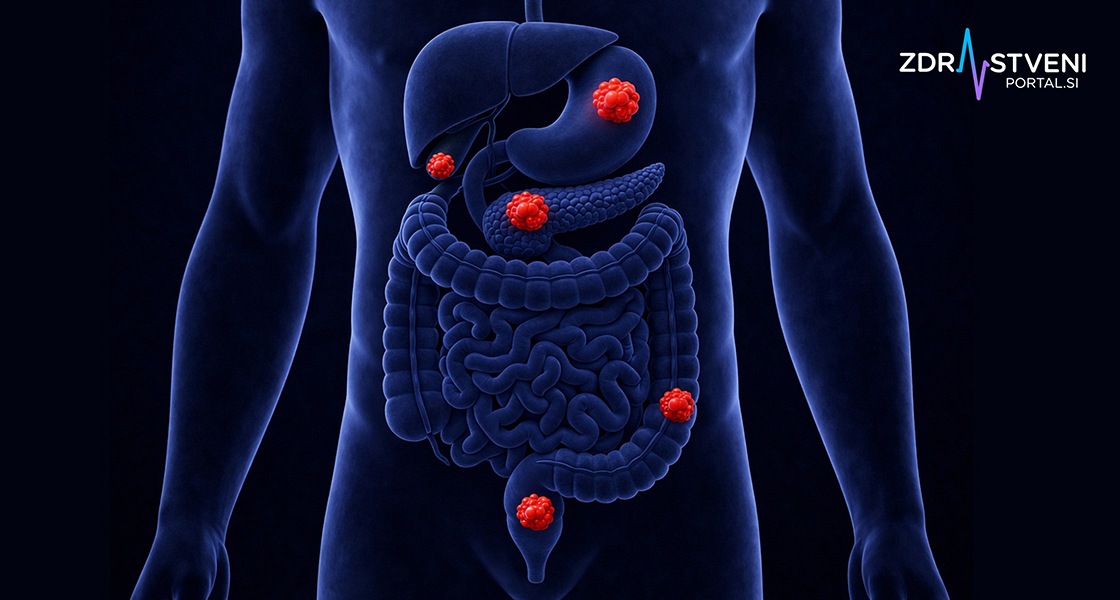 Rak debelega črevesja, rak trebušne slinavke in rak želodca: vzroki in preprečevanje, simptomi in čim zgodnejša diagnostika treh najpogostejših rakov prebavil