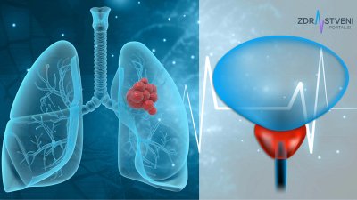 Rak prostate in rak pljuč – poznavanje simptomov in uvedba presejanja sta ključna za zgodnejšo prepoznavo bolezni, za pravočasni začetek zdravljenja in za zmanjšanje bolezenskega bremena