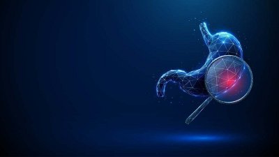 Raka želodca bi bilo mogoče preprečiti v skorajda 90-odstotnem deležu – s pravočasnim odkritjem in ozdravitvijo okužbe z bakterijo Helicobacter pylori, glavnim povzročiteljem te in številnih drugih bolezni 