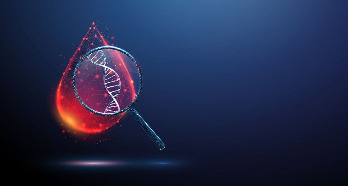 Za hemofilijo zbolevajo tudi ženske, ne le moški, vendar pri ženskah simptomi motenj strjevanja krvi bistveno pogosteje ostajajo prezrti ali napačno razumljeni