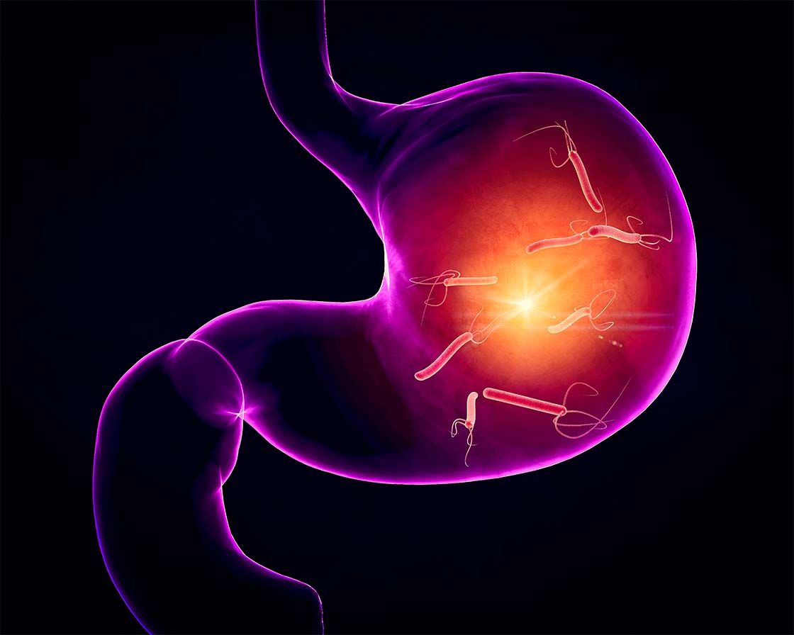 rak želodca presejalno testiranje in zdravljenje okužbe s h.pylori