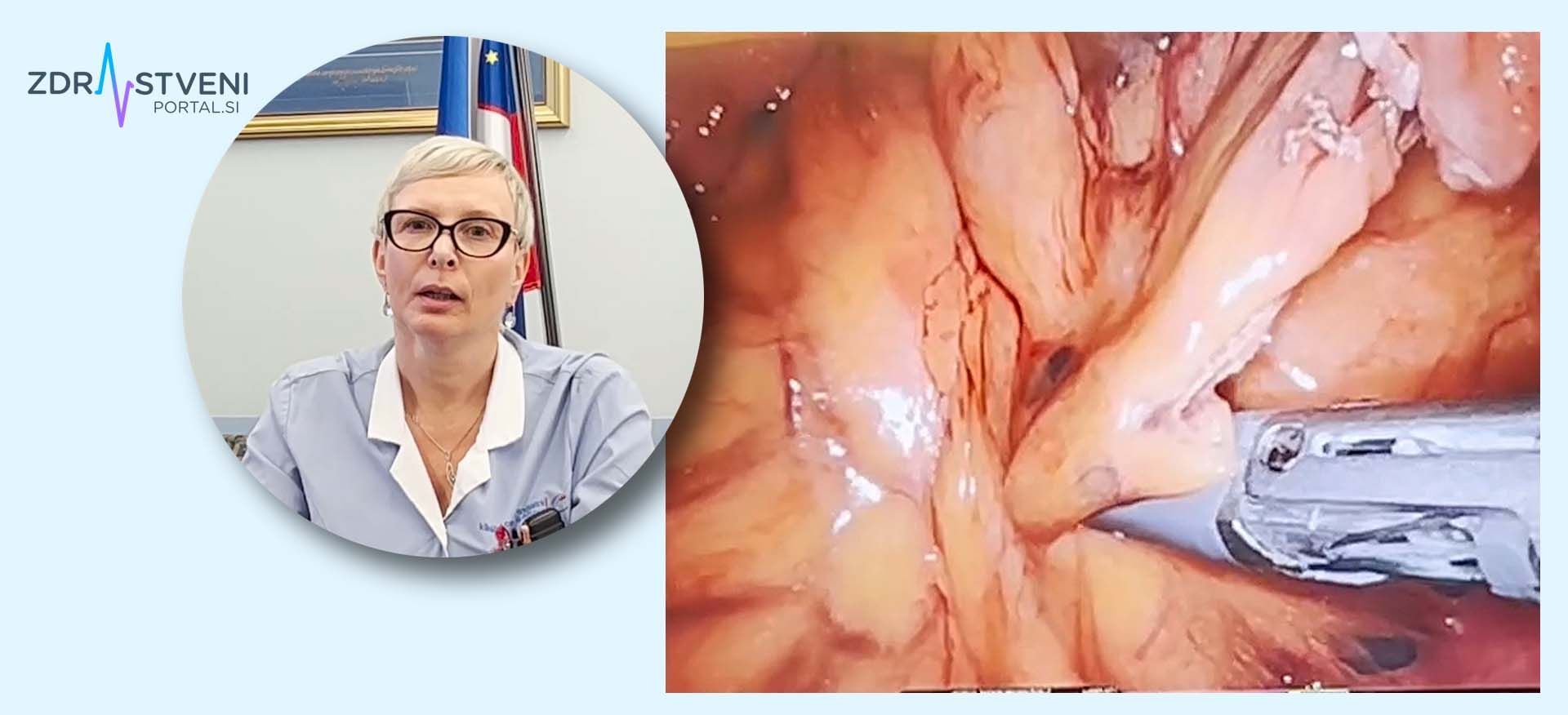 Robotska operacija na več organih Suzana Šega